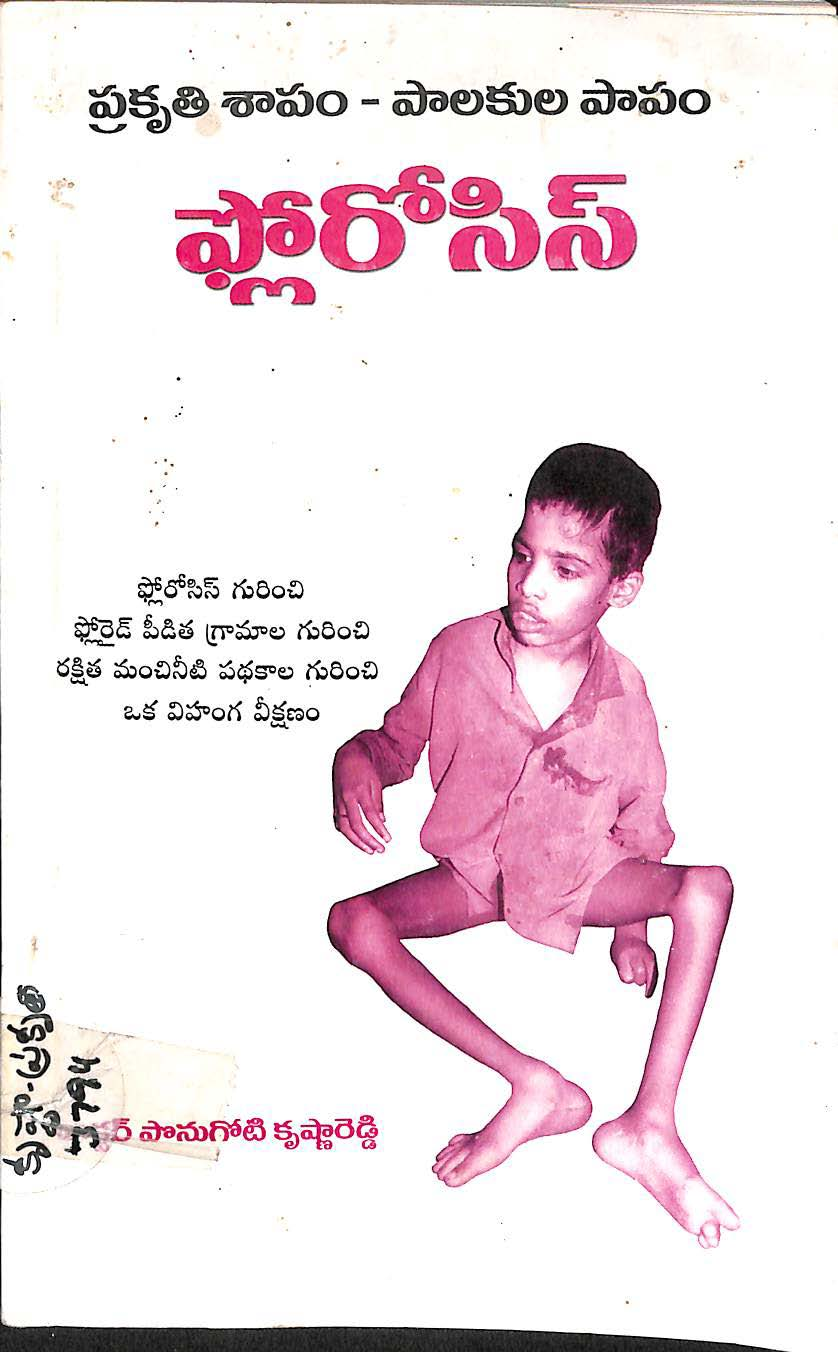 Prakruthi sapam-palakula papam Fluorosis