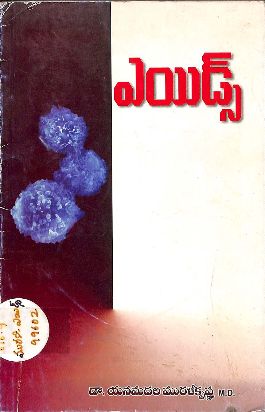 ఎయిడ్స్ 